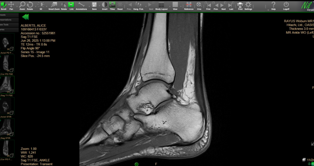 Scar tissue treatment at Mui Chiropractic in Newton MA